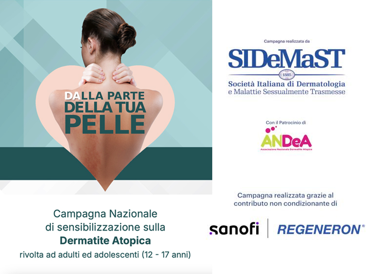 Tornano gli open day sulla dermatite atopica 2026