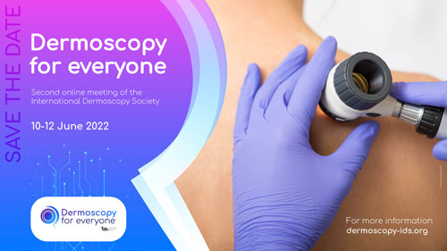 Dermoscopy for everyone