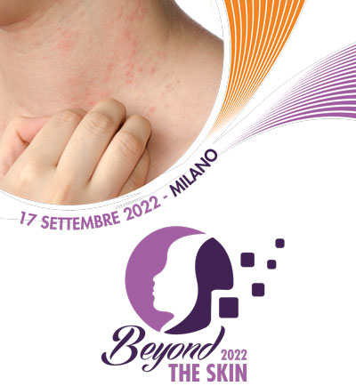 Beyond the skin - Itch & more