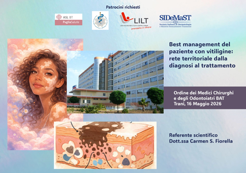 Best management del paziente con vitiligine: rete territoriale dalla diagnosi al trattamento