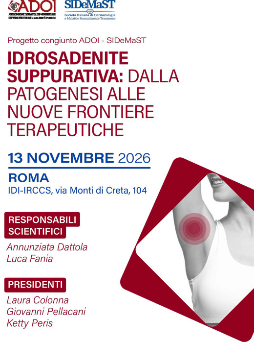 Idrosadenite Suppurativa: dalla patogenesi alle nuove frontiere terapeutiche