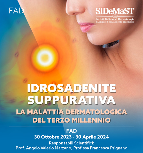 Idrosadenite suppurativa: la malattia  dermatologica del terzo millennio